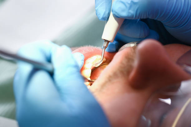 Best Urgent Tooth Repair  in Moss Beach, CA