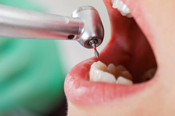 Best Broken Tooth Emergency  in Moss Beach, CA